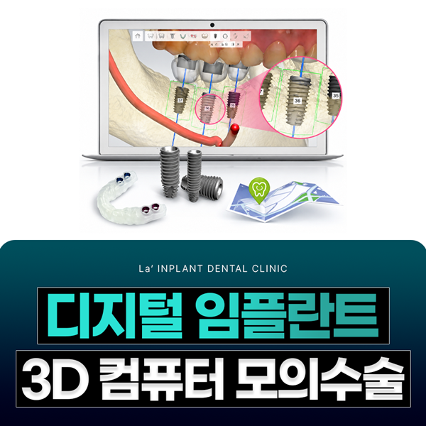 디지털 임플란트, 3D 컴퓨터 모의수술 정밀한 진단과 치료